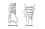 Neutralization and blade plates