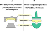 Two and three component ankle arthroplasties